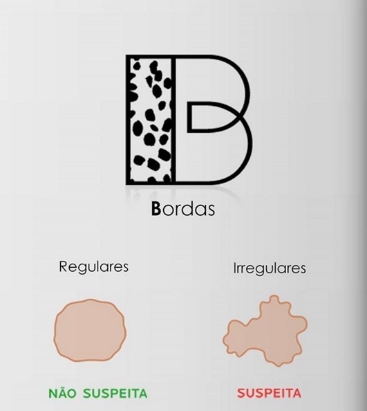 Descrição de pinta problemática em termos de bordas.