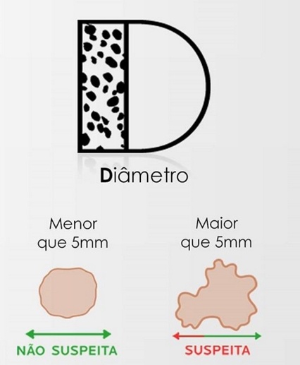 Descrição da problemática de pintas com diâmetro maior que 5mm.