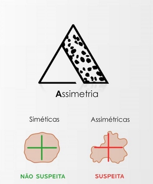 Descrição de pinta problemática em termos de assimetria