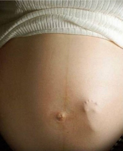 Sentir durante a gravidez - Just Real Moms