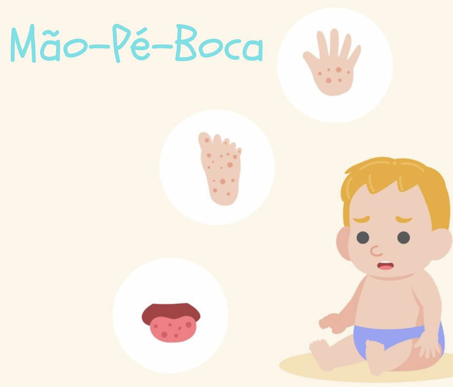 Desenho Mão Pé Boca Doença Clínica Coutinho Just Real Moms