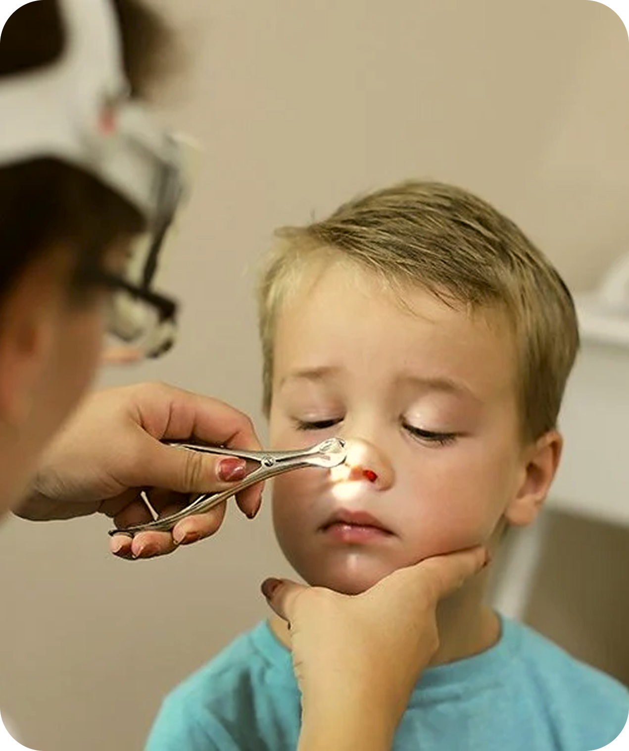 Cirurgia de Adenoide